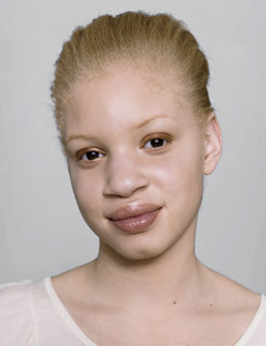 black woman white skin